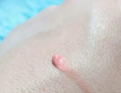 Biodermal Sun Lipbalm SPF25 - Tube 12 Ml - Natural Pink - Lippenbalsem -Cosmetica Aanbiedingen 1200x927